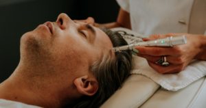 technique de soin microneedling sur un visage pour régénérer la peau
